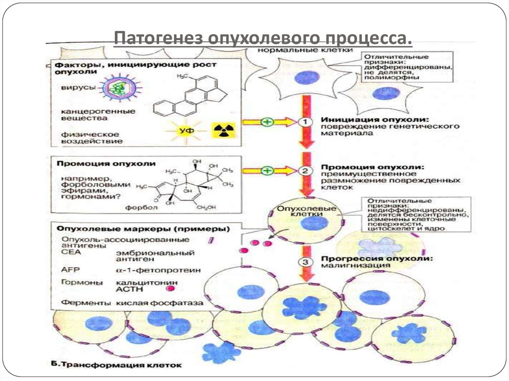 Схема патогенеза опухоли