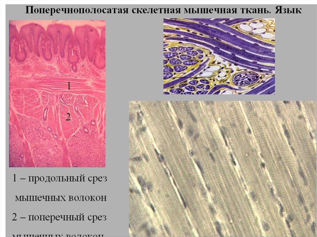 Язык ткани. Поперечно-полосатая мышечная ткань препарат гистология. Поперечно-полосатая Скелетная мышечная ткань препарат. Срез языка гистология поперечно-полосатая мышечная ткань. Припарат паперечна Полосотый склетная мышечная ткан.