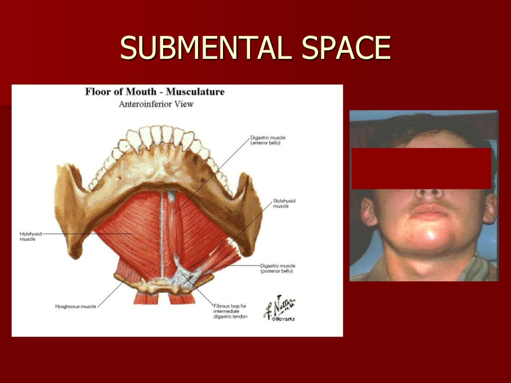 Surgical fascial spaces - online presentation