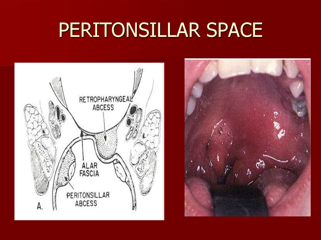 Surgical fascial spaces - online presentation