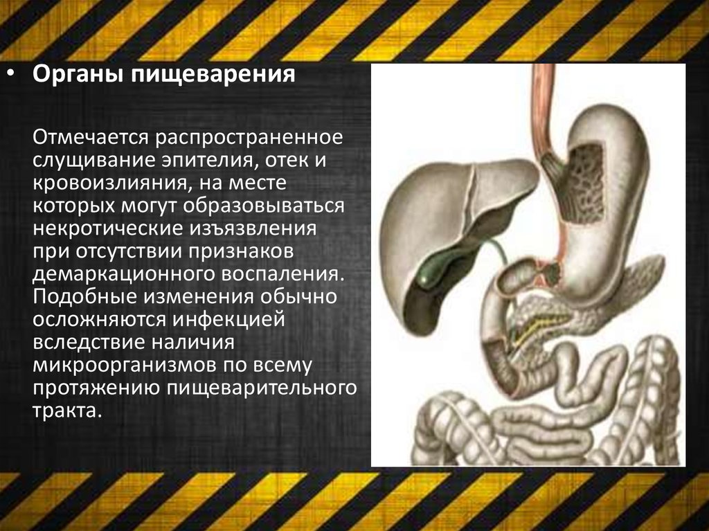 Радиационное поражение презентация