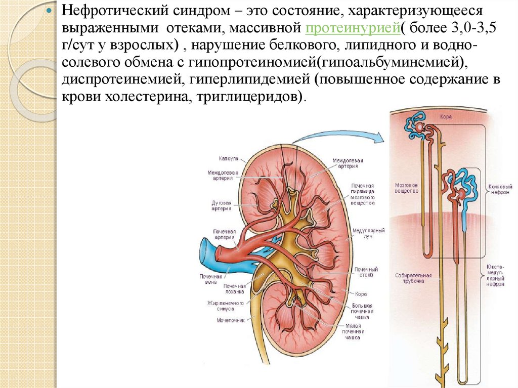 Нефротический. Нефротический синдром. Нефротический синдром характеризуется. Нефротический синдром презентация. Классификация нефронов почки.