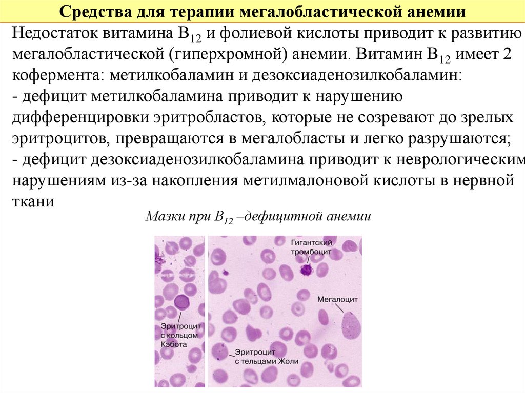 К анемии может привести недостаток. В12 мегалобластная анемия. Б12 дефицитная анемия гиперхромная. Витамин в12 -дефицитная анемия (мегалобластная). Препараты при мегалобластной анемии.