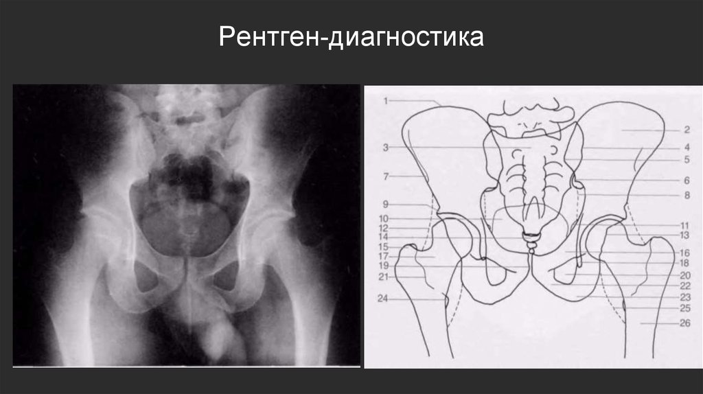 Рентген-диагностика