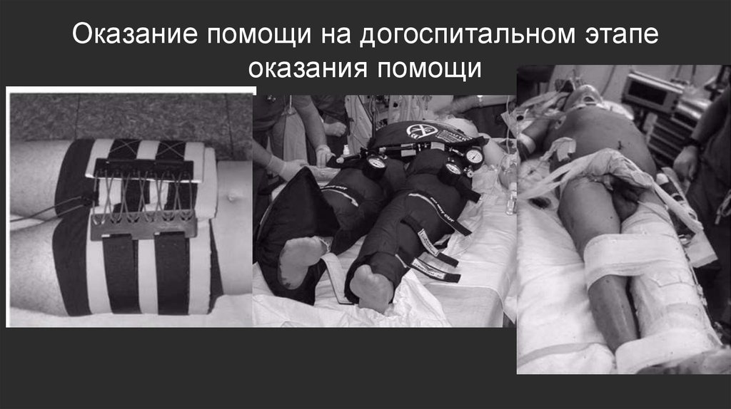 Оказание помощи на догоспитальном этапе оказания помощи