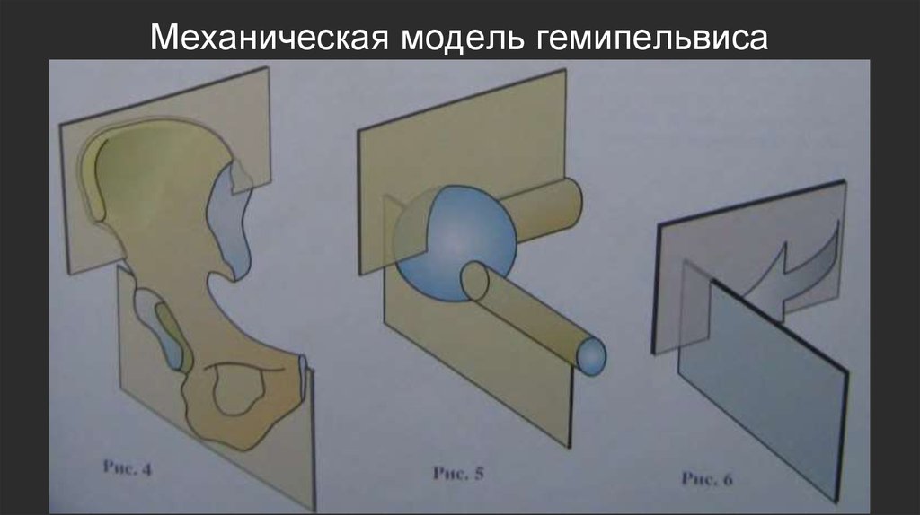 Механическая модель гемипельвиса