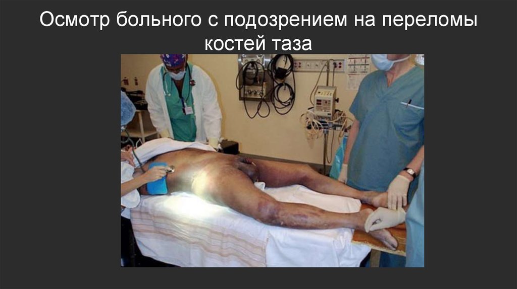 Осмотр больного с подозрением на переломы костей таза