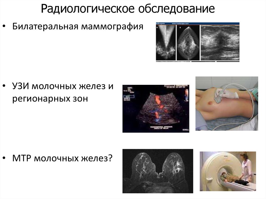 Пальпация молочной железы презентация