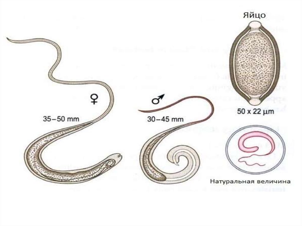 Тело червей разделено на. Красные круглые черви в Судаке. Живородящие круглые черви примеры.