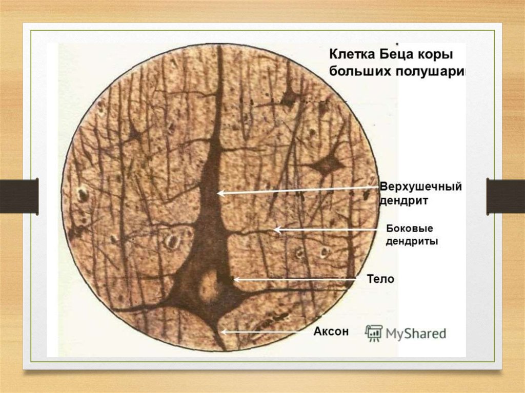 Головной мозг гистология презентация