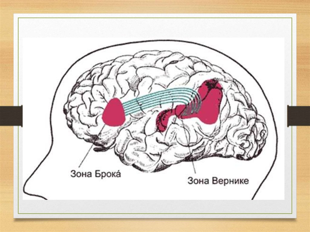 Зона отвечающая за речь. Зона Брока и зона Вернике. Центры Брока и Вернике в головном мозге. Речевые центры Брока и Вернике. Речевые зоны коры головного мозга Брока.