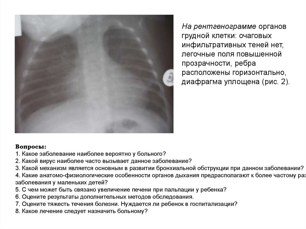 Пример описания рентгенограммы