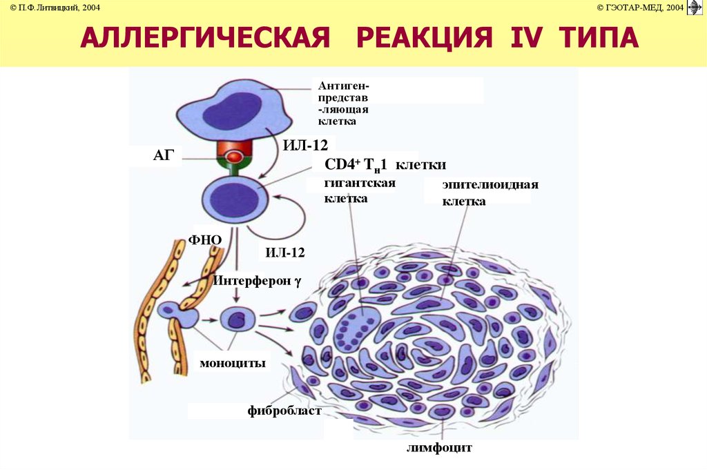 Схема аллергической реакции медиаторного типа