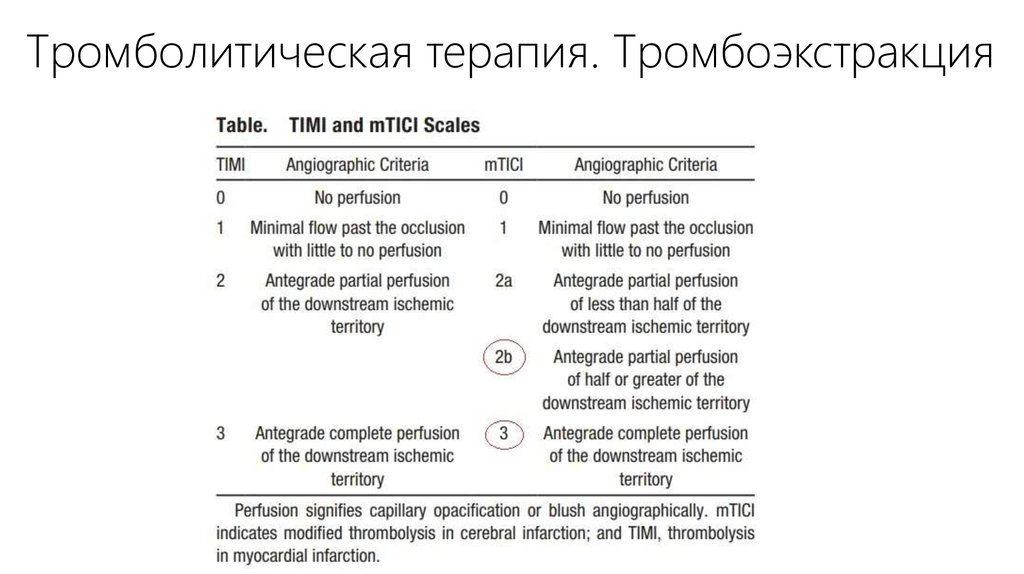 Тромболитическая терапия. Тромбоэкстракция