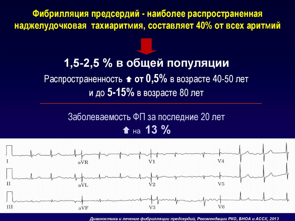 Фибриляция предсердий. Фибрилляция и трепетание предсердий. Терапия трепетания предсердий. Трепетание предсердий классификация. Для трепетания предсердий характерно:.