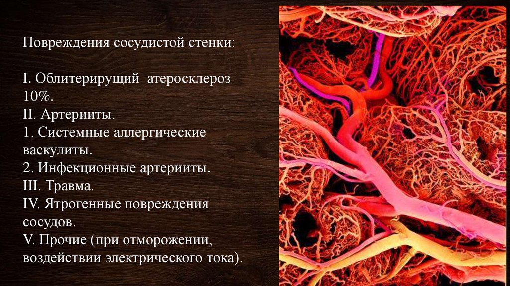 Повреждение стенок. Системные васкулиты артериит Такаясу. Повреждение сосудистой стенки.