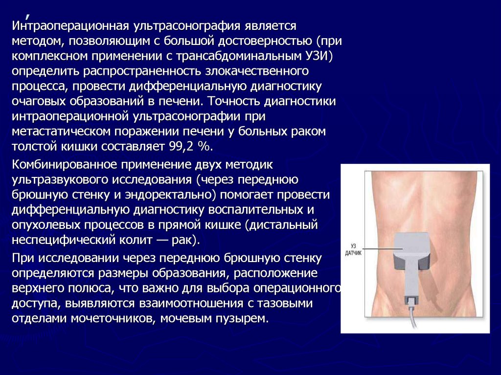 Метод позволяющий. Интраоперационное УЗИ. Интраоперационная ультрасонография. Ультрасонография прямой кишки. Современные методы диагностики заболеваний толстой кишки.