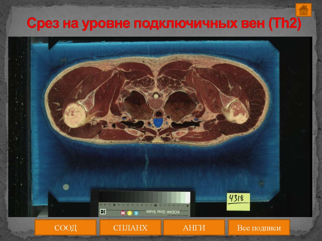 Как работают срезы. Анатомический срез человека. Срезы тела в диагностике.