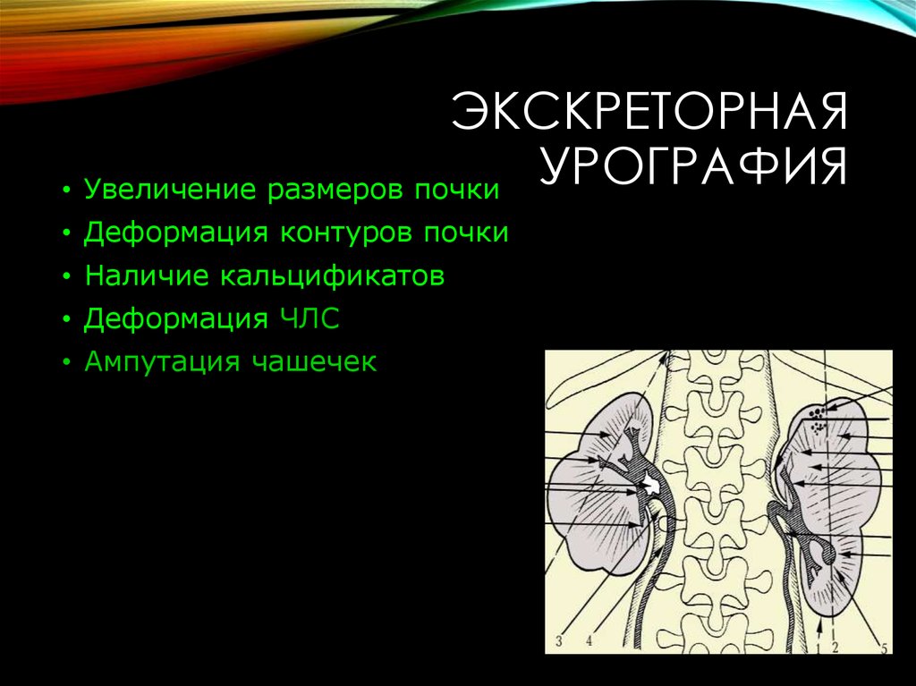 Почки контуры ровные. Деформация контура почки. Деформация контура почки на кт. Усиление рисунок лоханочных структур.. Контуры почек на рентгене.