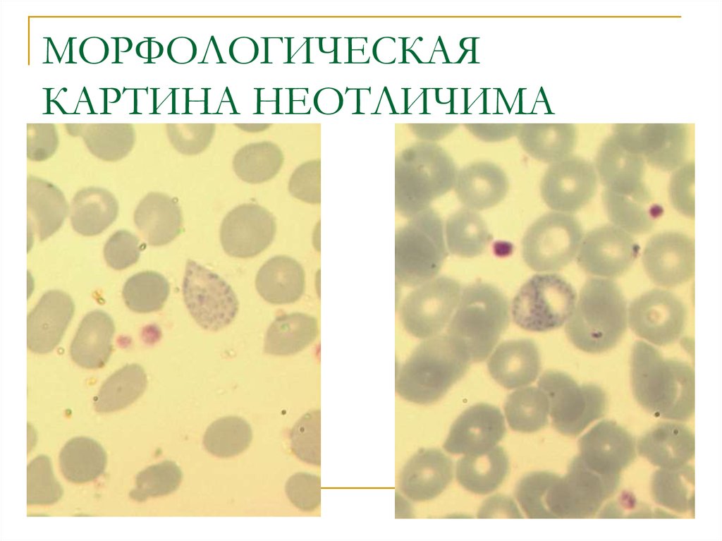 Что означает морфологическая картина