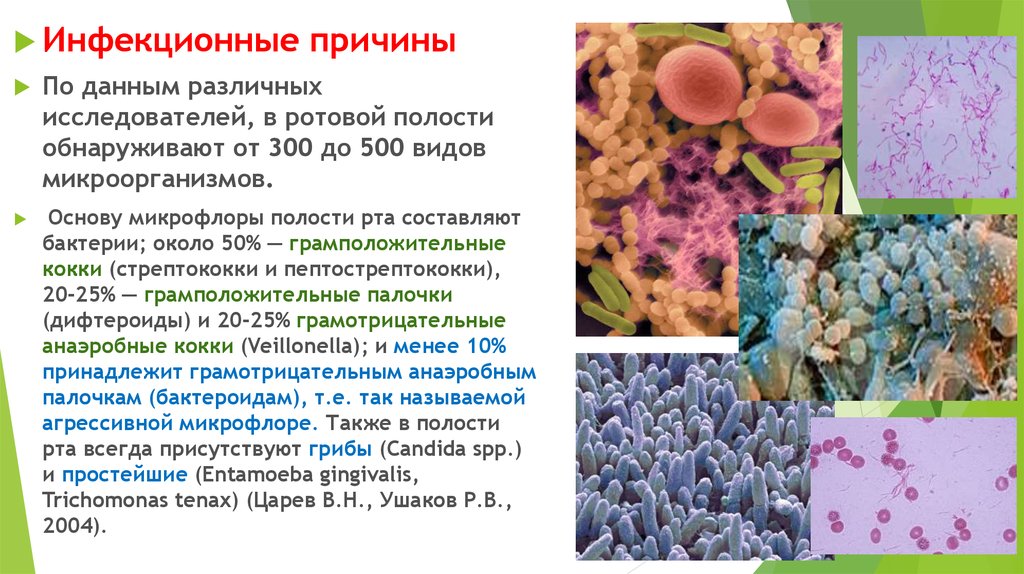 Бактерии в основе. Микрофлора полости рта микробиология. Бактерии полости рта микробиология.