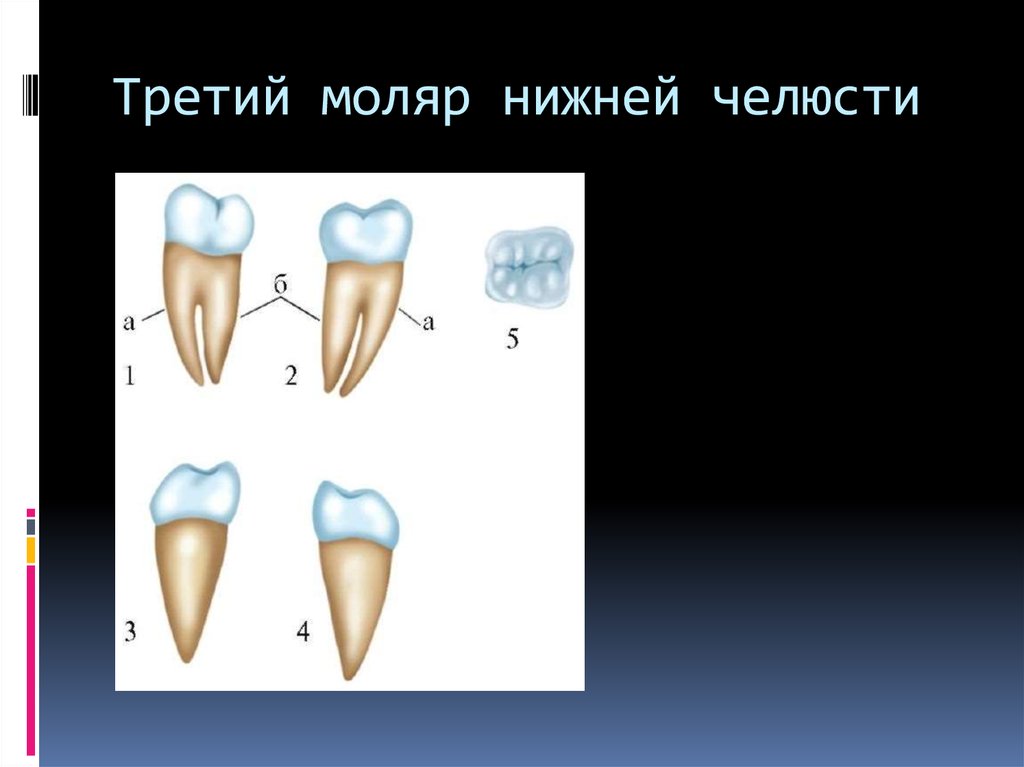 Коренной зуб в челюсти. Третий моляр нижней челюсти анатомия зуба. Третий Нижний моляр анатомия. 1-Й моляр нижней челюсти. 3 Моляр верхней челюсти анатомия.