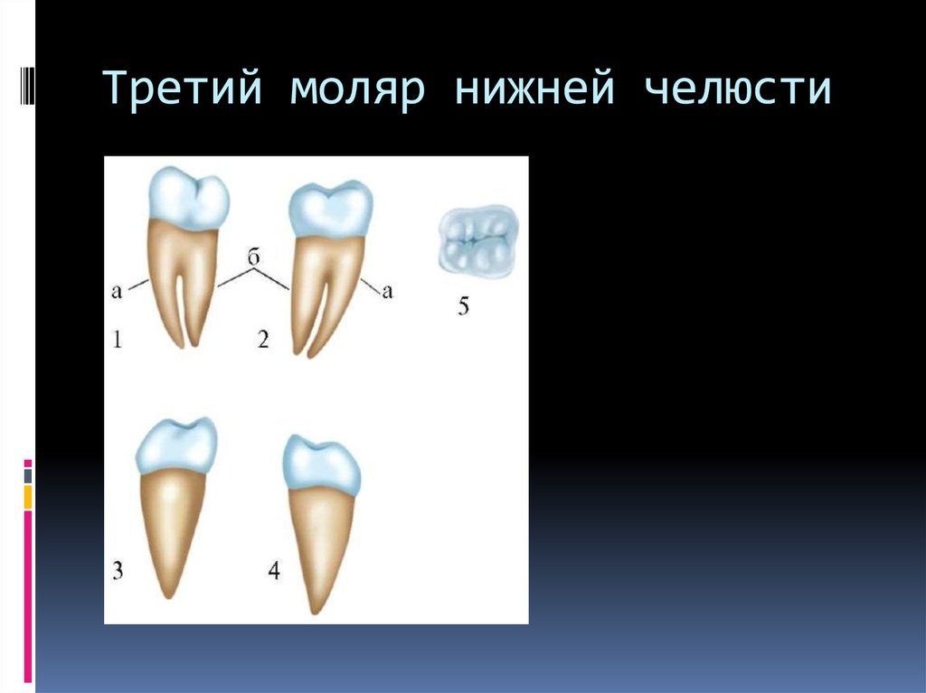 Коренной зуб в челюсти