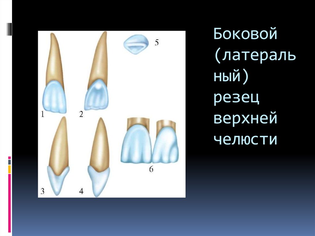 Зуб боковой резец. Латеральный резец верхней челюсти анатомия. Нижний латеральный резец анатомия. Боковой резец верхней челюсти анатомия. Строение зуба резца сбоку.
