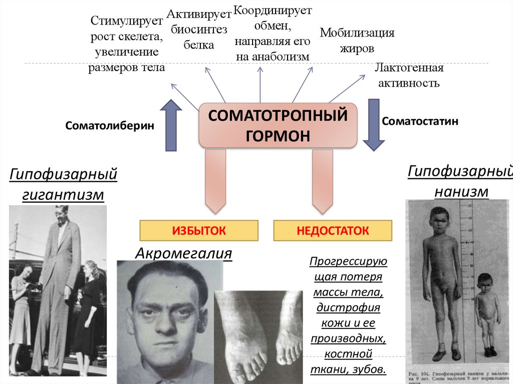 Болезнь роста. Соматостатин избыток и недостаток. Недостаток соматостатина болезнь. Соматостатин заболевания при избытке и недостатке. Гигантизм заболевание при недостатке.