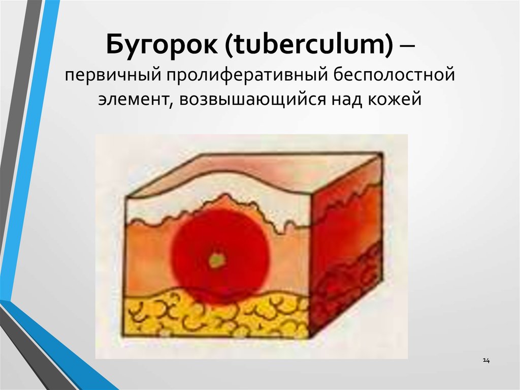 Первичные элементы кожной сыпи