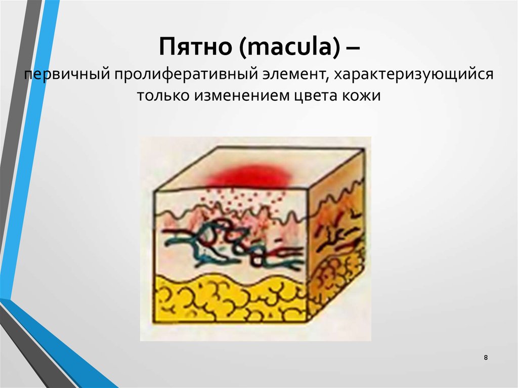 Первичные элементы кожной сыпи