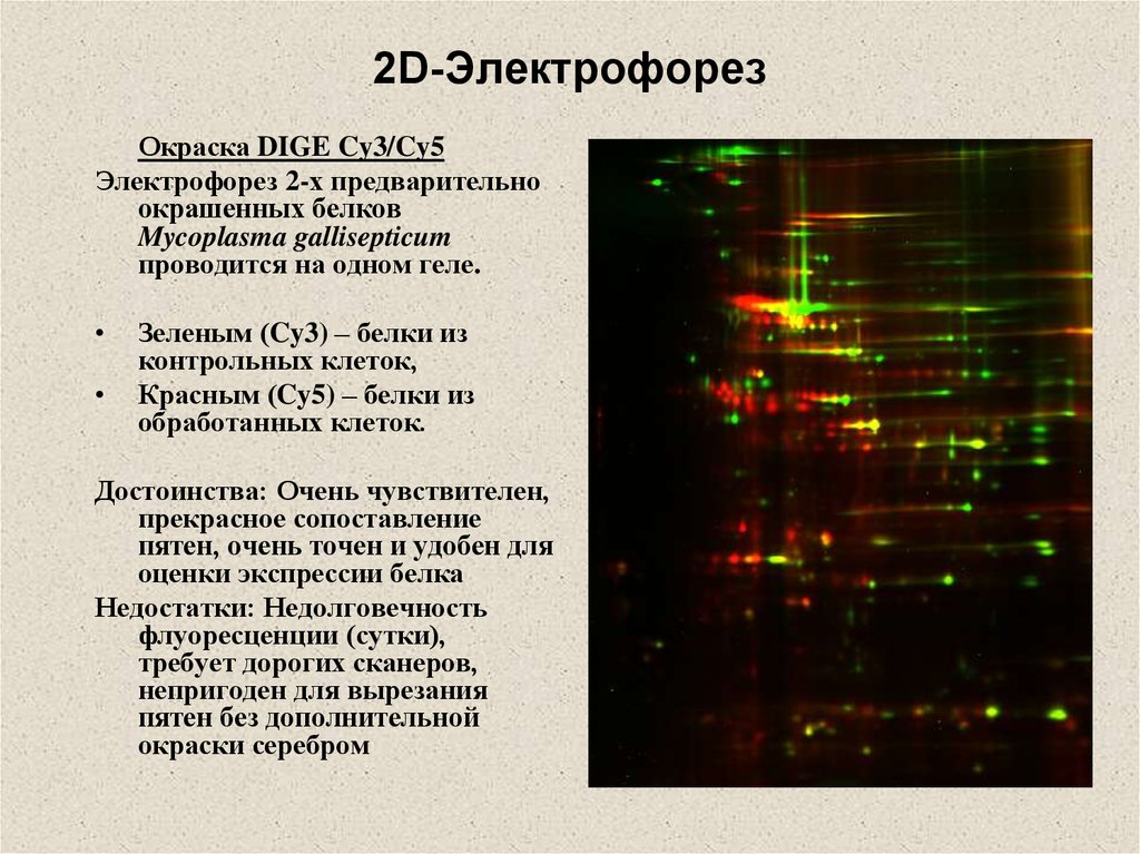 Электрофорез карта осу