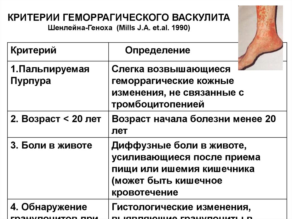 Локальный статус нижних конечностей. Диагностические критерии геморрагического васкулита. Геморрагический васкулит кожный симптом. Болезнь Шенлейна-Геноха клинические симптомы. Основные клинические симптомы геморрагический васкулит.