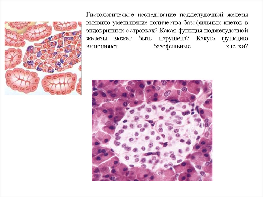 Исследование железы. Поджелудочная железа железа гистология препарат. Поджелудочная железа препарат экзокринная часть. Гистологическое строение поджелудочной железы гистология. Поджелудочная железа гистология препарат.