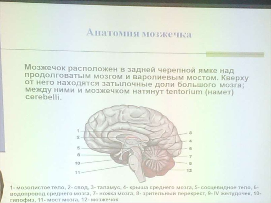 Мр картина низкого расположения миндалин мозжечка