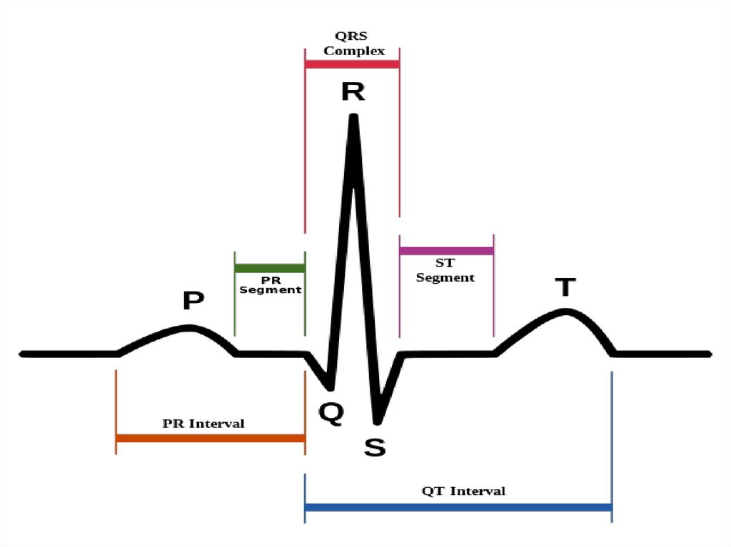 Qrs на экг что это. Комплекс QRS на ЭКГ. Длительность комплекса QRS на ЭКГ. Расширение комплекса QRS на ЭКГ. Интервал QRS на ЭКГ.