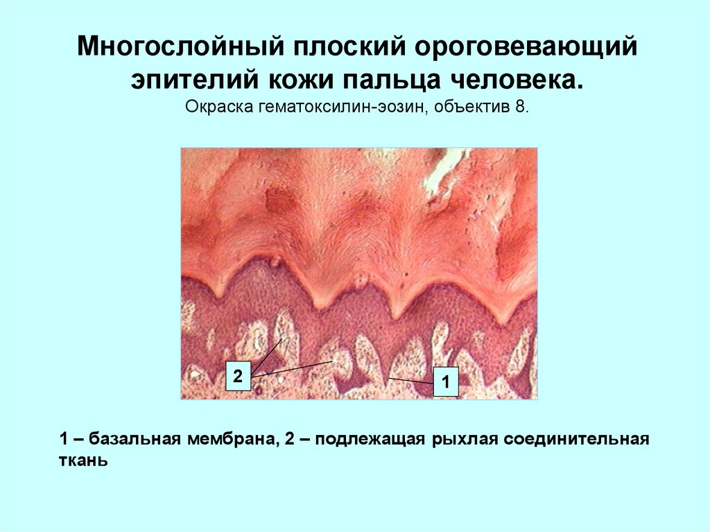 Многослойный плоский ороговевающий эпителий кожи пальца рисунок