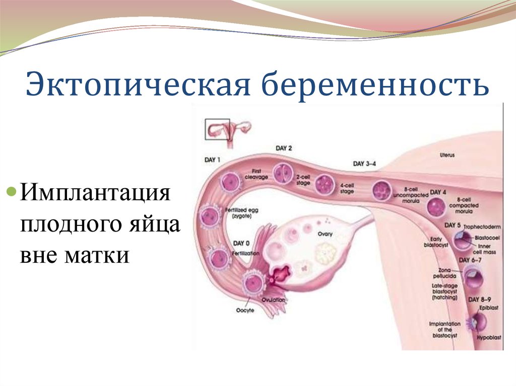 Забеременела вне овуляции