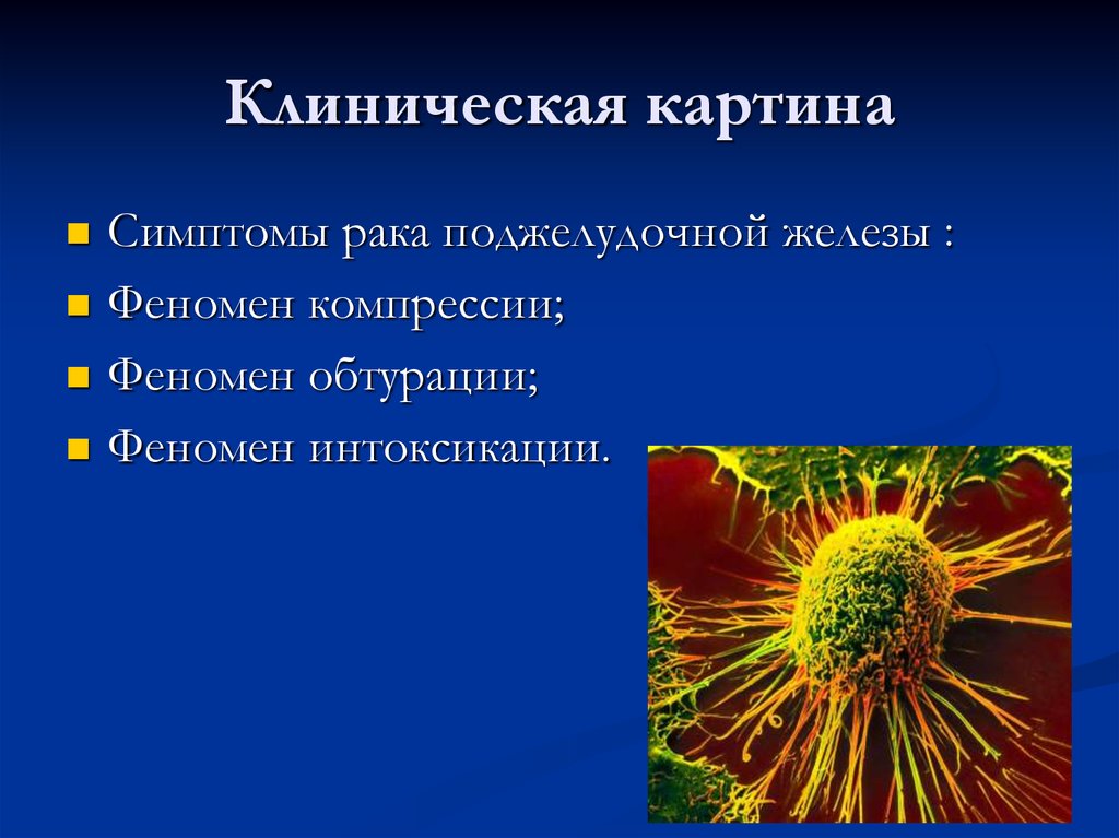 Клиническая картина рака. Феномен компрессии онкология. Феномен интоксикации. Феномен обтурации онкология.