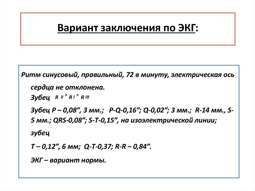 Определение экг по фото онлайн