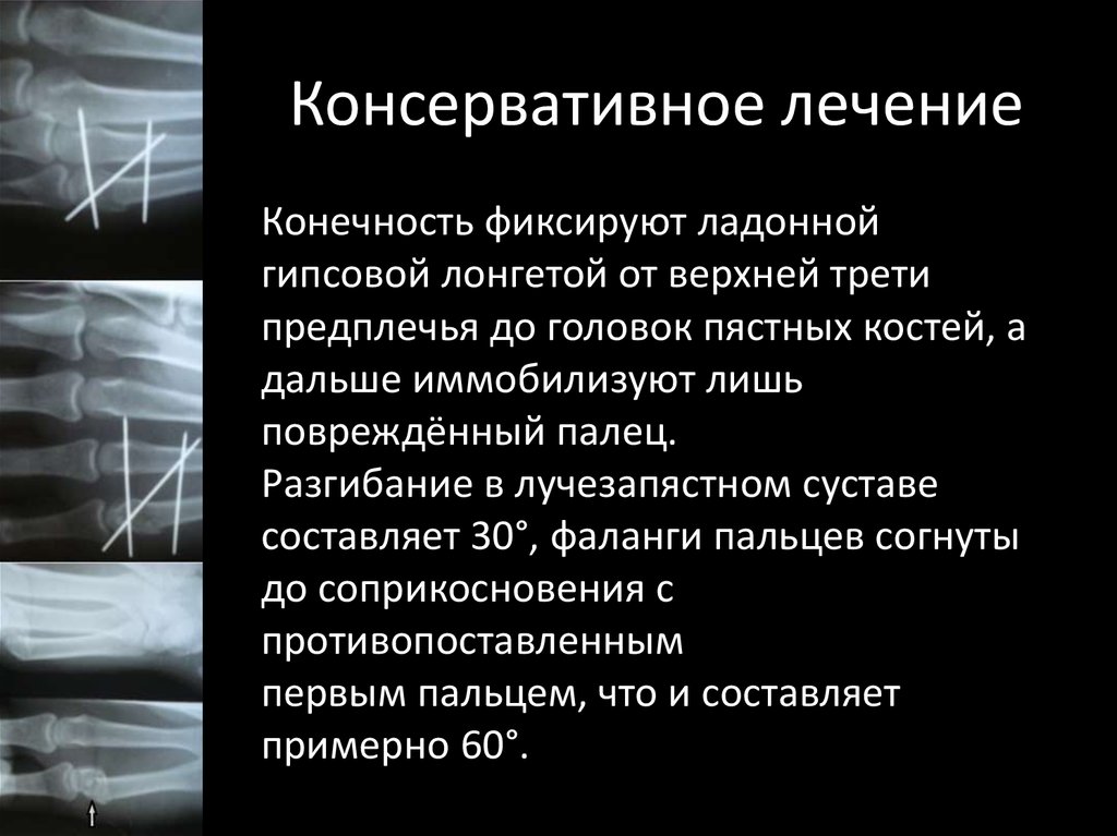 Консервативное лечение