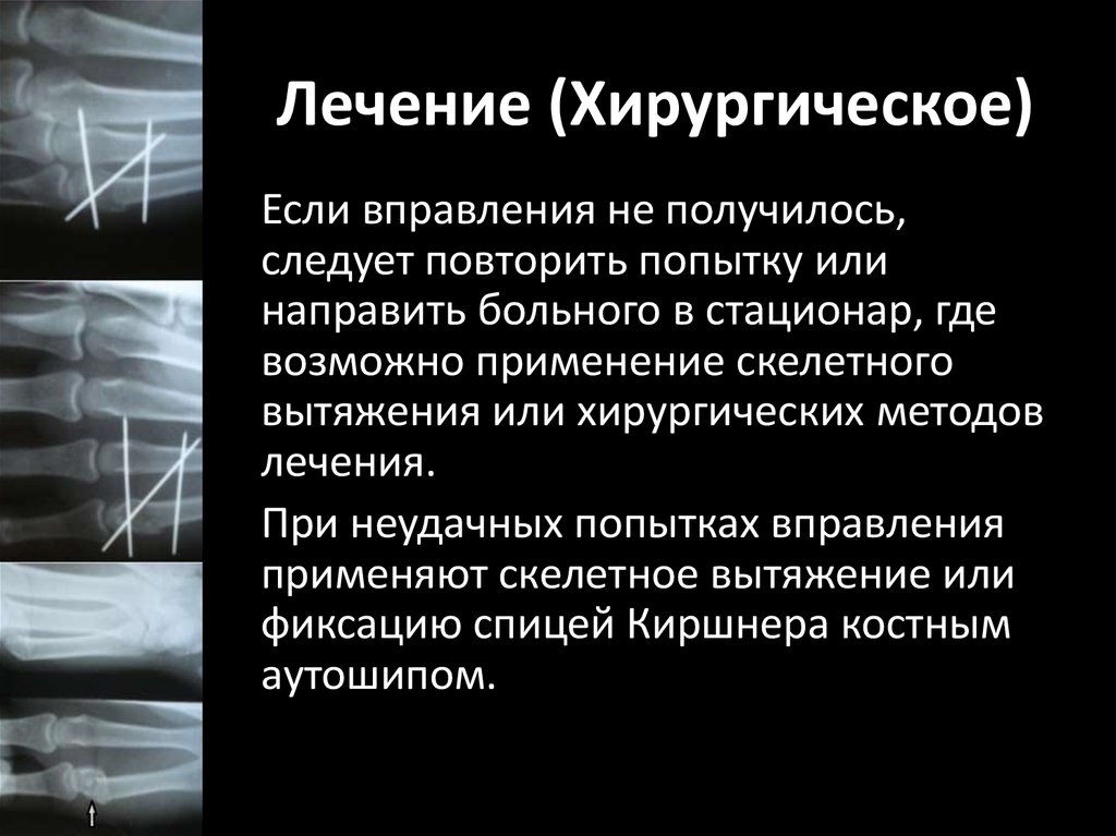 Лечение (Хирургическое)