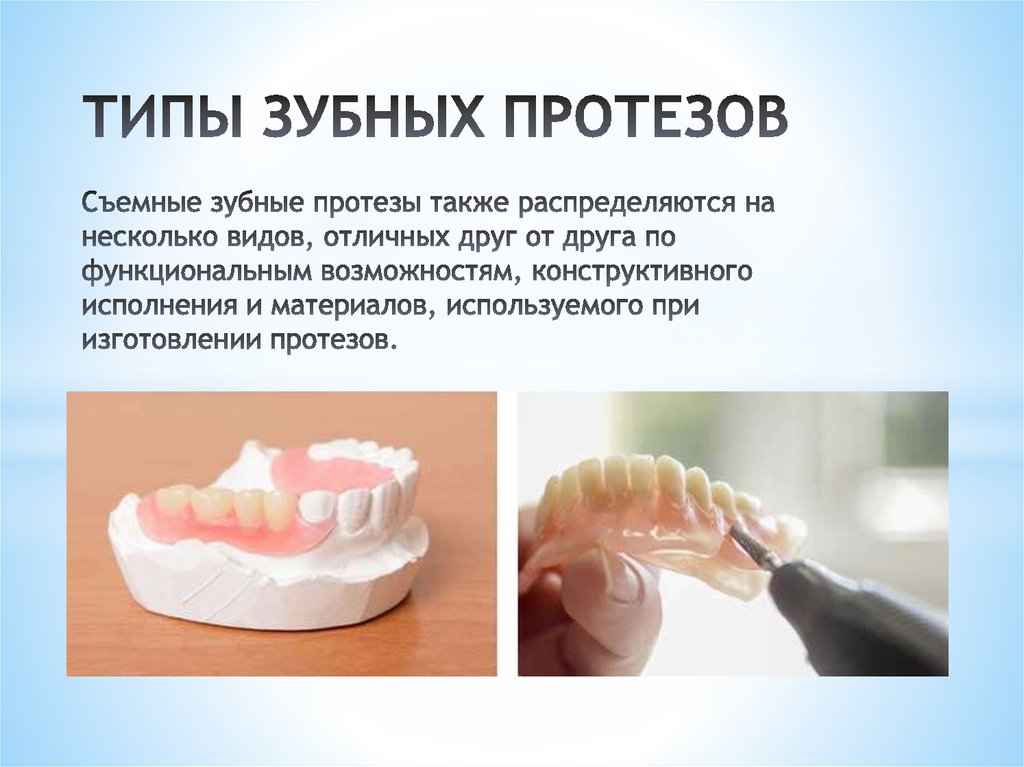 Как называется протезист. Типы съемных зубных протезов. Съемные и несъемные протезы в стоматологии. Съёмные протезы зубов материалы.