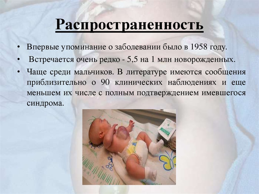 Распространенность