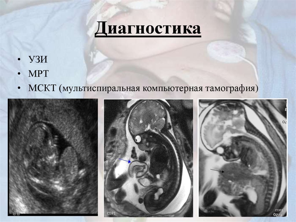 Диагностика