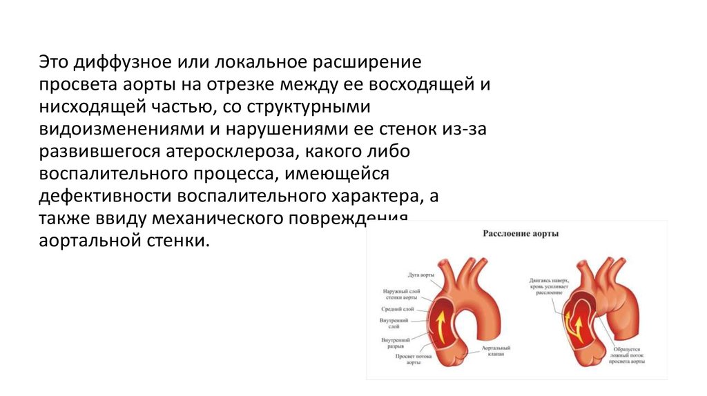 Корни аорты фиброзны