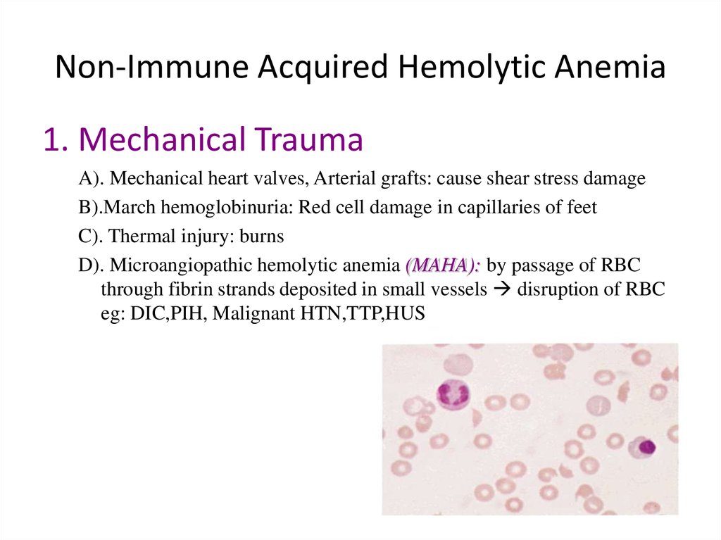 Hemolytic Anemia Online Presentation