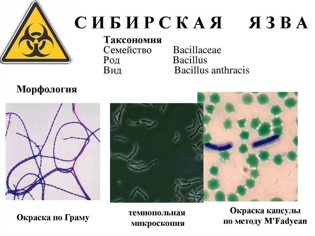 Карта сибирская язва