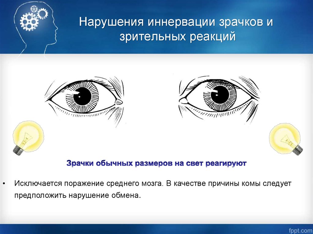 Нарушение реакции. Нарушение зрачковых реакций. Реакция зрачков на свет. Исследование реакции зрачков на свет. Иннервация зрачка.