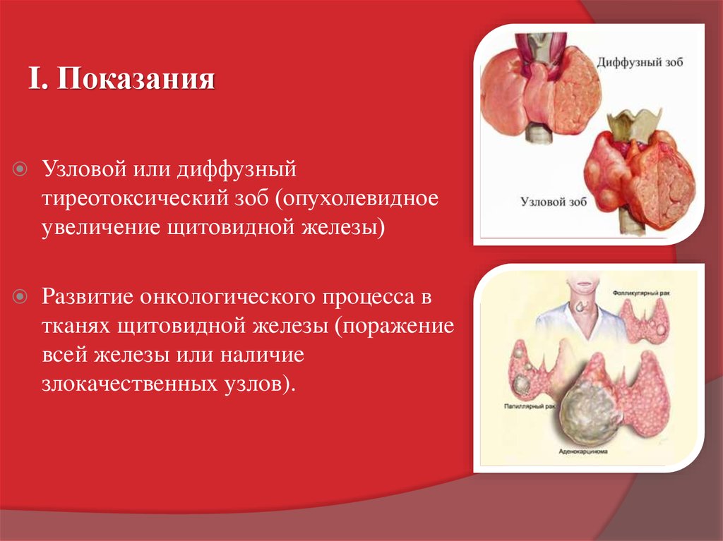 Мкб заболевания щитовидной железы